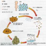 尿石発生のメカニズム